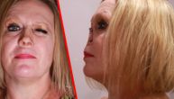 Žena bez nosa izgubila je svaku nadu, a onda joj se dogodio preokret života (VIDEO)