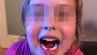 Snimak devojčice koja sama sebi vadi mlečni zubić oduševio je Srbiju (VIDEO)