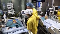Fotografije operacije kojom su razdvojeni sijamski blizanci: Glave su im bile spojene 3 godine