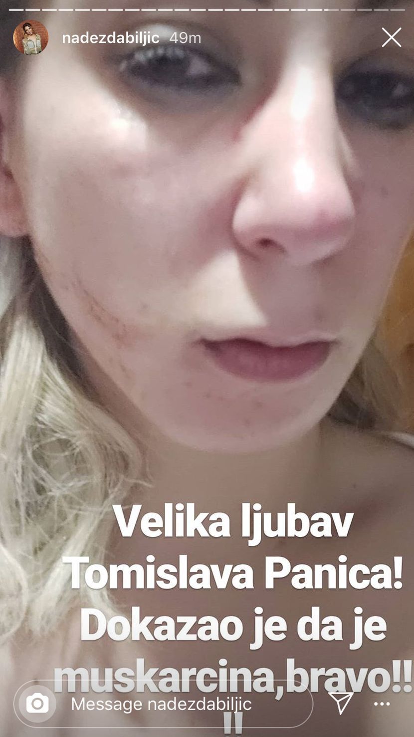 Nadežda Biljić pretučena Nadežda Biljić pretučena