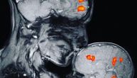 Magnetna rezonanca po prvi put snimila moždanu aktivnost koja označava vezu majke i deteta (FOTO)