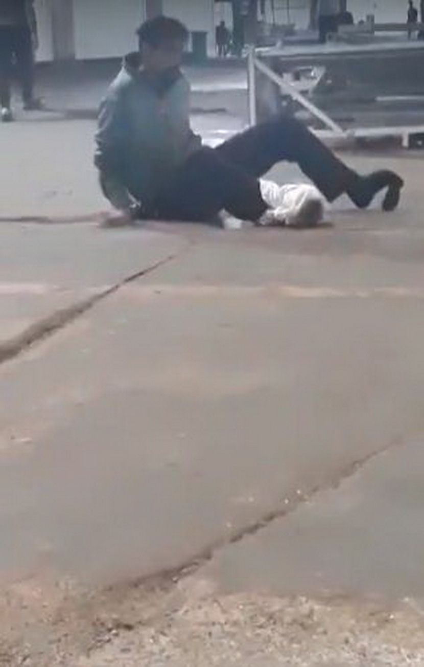 Migrant sa spaljenom nogom Migrant sa spaljenom nogom