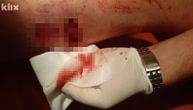 Pas izgrizao nogu dečaku u Sarajevu, a povrede okarakterisane kao lakše (UZNEMIRUJUĆE)