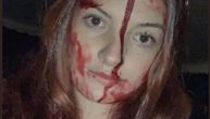 Devojka se slupala nakon žurke za Noć veštica: Doktori zbog jednog detalja mislili da je mrtva