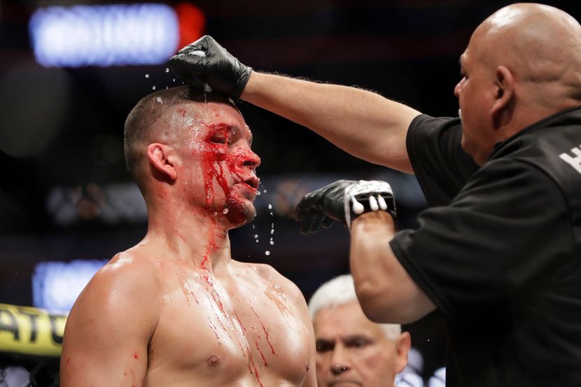 Nate Diaz Nate Diaz