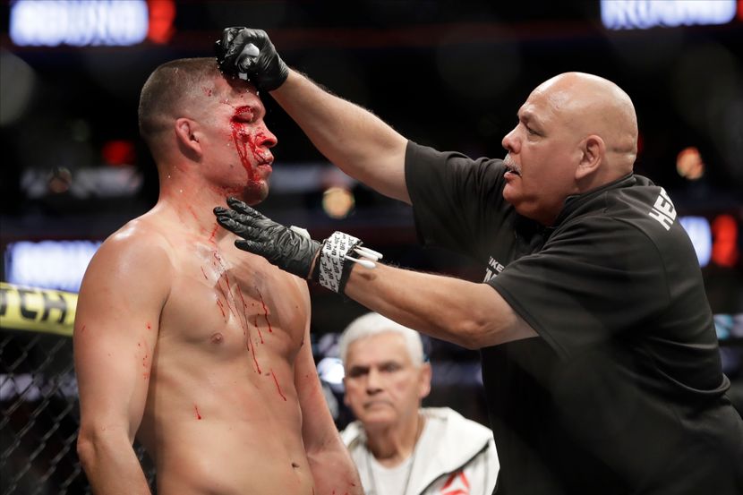 Nate Diaz Nate Diaz