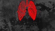 Najveći strah asimptomatskih slučajeva: Da li možete razviti upalu pluća bez ijednog znaka korone?