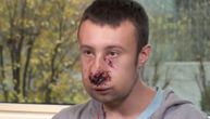 Policija koristi "ratno oružje" protiv "žutih prsluka": Granata mu je eksplodirala ispred lica