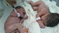 Blizanci rođeni samo 20 minuta posle razornog zemljotresa u Albaniji