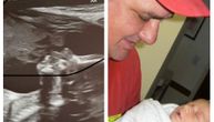 Trudnica objavila neobičnu sliku sa ultrazvuka: Svi su primetili "anđela" kako ljubi bebu