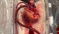 Doktori oživeli srce preminulog donora organa: Pionirska procedura prvi put uspešno izvršena u SAD