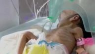 Beba čudo: Prevremeno rođena devojčica, koja je živa zakopana, potpuno se oporavila i premedena je