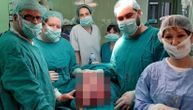 Beogradski lekari izvadili tumor od pola metra: Pacijentkinja nije ni znala šta joj raste u stomaku