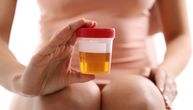 Boja urina upozorava na veliki zdravstveni rizik: Ako primetite ovu promenu, odmah se javite lekaru