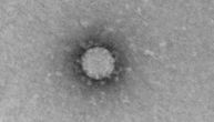Prvi mikroskopski snimci korona virusa