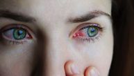 Ovaj problem sa očima može da bude mogući simptom korona virusa, a sekret da ga širi dalje
