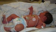 Tek rođena beba se "borila za život" nakon infekcije korona virusom, roditelji negativni