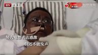 Dvojica Kineza nakon najtežih simptoma korona virusa postali potpuno crni: Kako je ovo moguće?