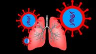 Čak 60 odsto ljudi bez simptoma korona virusa imalo je upalu pluća: Kako je to moguće?