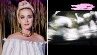 Pevačica radila ultrazvuk i nije mogla da veruje: Beba je "počastila" srednjim prstom