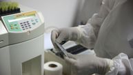 Stigle prve prijave privatnih laboratorija za PCR testiranje na koronu