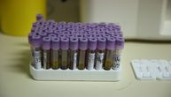 Skok zaraženih u Crnoj Gori: Još 66 osoba inficirano korona virusom