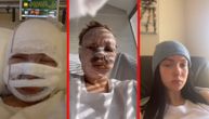 Devojka se suočila sa hororom: Lice joj je potpuno izgorelo ali optimizam ubrzao je proces oporavka