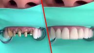 Stomatolog postao zvezda na internetu zbog snimka kako popravlja zube