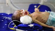 Dečja bolnica koja bukvalno predstavlja pakao na Zemlji: Izmučeni mališani umiru čekajući pomoć