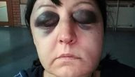 Ženu iz Šapca brutalno pretukao taksista: "Udarao me je u glavu, izvinite na slikama, potresne su"