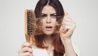 Opadanje kose: Ulja koja možete koristiti kod kuće i ojačati vlasi