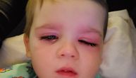 “Moj sin je prsnuo vodu u oko iz gumene igračke za kupanje. Ubrzo je počeo pakao, zamalo je oslepeo"