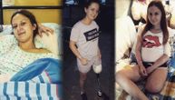 Nataša je sa 18 ostala bez noge: Kobnog dana, dok je vozila bicikl, njen život se promenio iz korena