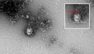 Objavljena prva fotografija novog soja korona virusa koji je stigao i u Srbiju