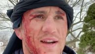 Osetio sam kako mi koža otpada: Velika glupost UFC borca! Mislio da je sneg, pa skočio na led