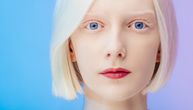 Šarm albino ljudi podjednako prenosi i profesionalna i amaterska fotografija