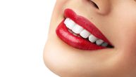 6 aktuelnih trendova koji bi mogli da povrede vaše zube