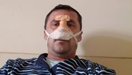Strah napadnutog Srbina iz Velike Hoče: Plašim se da se vratim kući, ko će da me zaštiti?