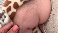 "Izdepiliraj ga": Mama podelila video bebe prekrivene maljama, komentari potpuno neprimereni