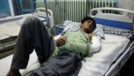 Ispovest lekara koji je zbrinuo žrtve napada u Kabulu: Nisu mogli da govore, pogled im je bio prazan
