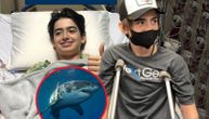 Dečaka odvukla ajkula u more tokom proslave 15. rođendana: "Mislio sam da ću izgubiti nogu"