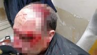 Mučki tukli radnika obezbeđenja u Boru: Uhapšeni osumnjičeni zbog napada