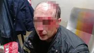 Brutalno pretučen radnik obezbeđenja u Boru: Onesvestili ga udarcem u glavu, pa nastavili da ga šutiraju