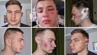 Ovo su mladići koji su brutalno pretučeni u Prijepolju: "Gazda i sinovi bokseri su ih šutirali u glavu i telo"