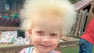 Lejla ima sindrom neočešljane kose, majka priznaje: "Njene vlasi je nemoguće dovesti u red"