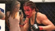 Krvava noć za jednu od najlepših UFC borkinja: Fali joj komad čela, hitno je prevezena u bolnicu