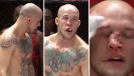 Uznemirujuće: Najbrutalniji lom nosa u MMA istoriji, kolenom udario rivala svom silinom po licu