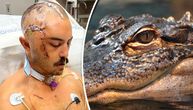 "Zubima mi je probušio lobanju, bio sam mu u čeljustima": Mladić preživeo napad aligatora, drug snimao dronom