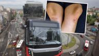 Vožnja Slavijom na kolenima: Putnica modra i pocepana, bila sama u autobusu, vozač nije ni trepnuo
