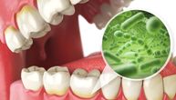 Bakterije i gljivice mogu da se kreću po površini zuba, a najopasnije je kada deluju zajedno